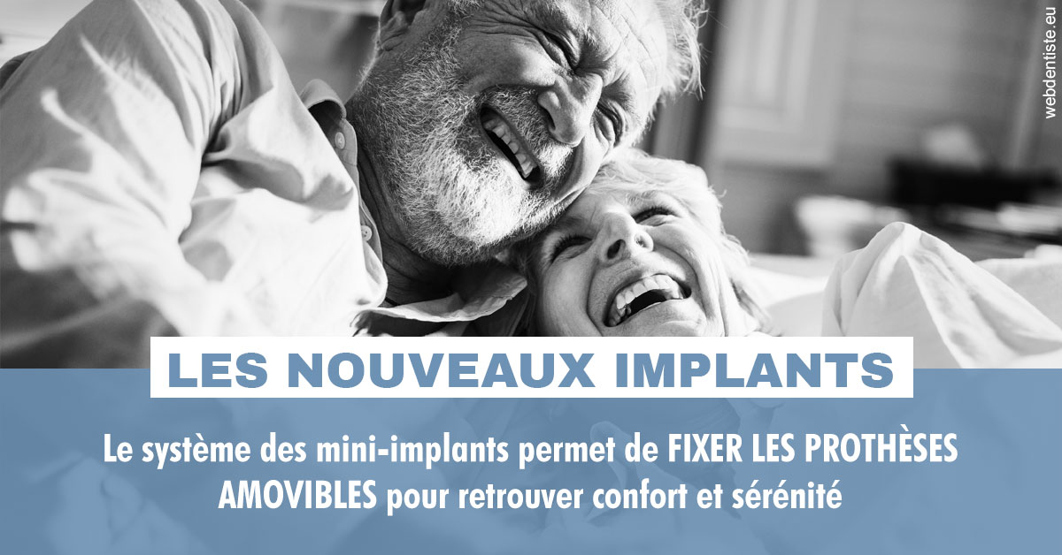 https://docteur-alexandre-benoit-lentrebecq.chirurgiens-dentistes.fr/Les nouveaux implants 2