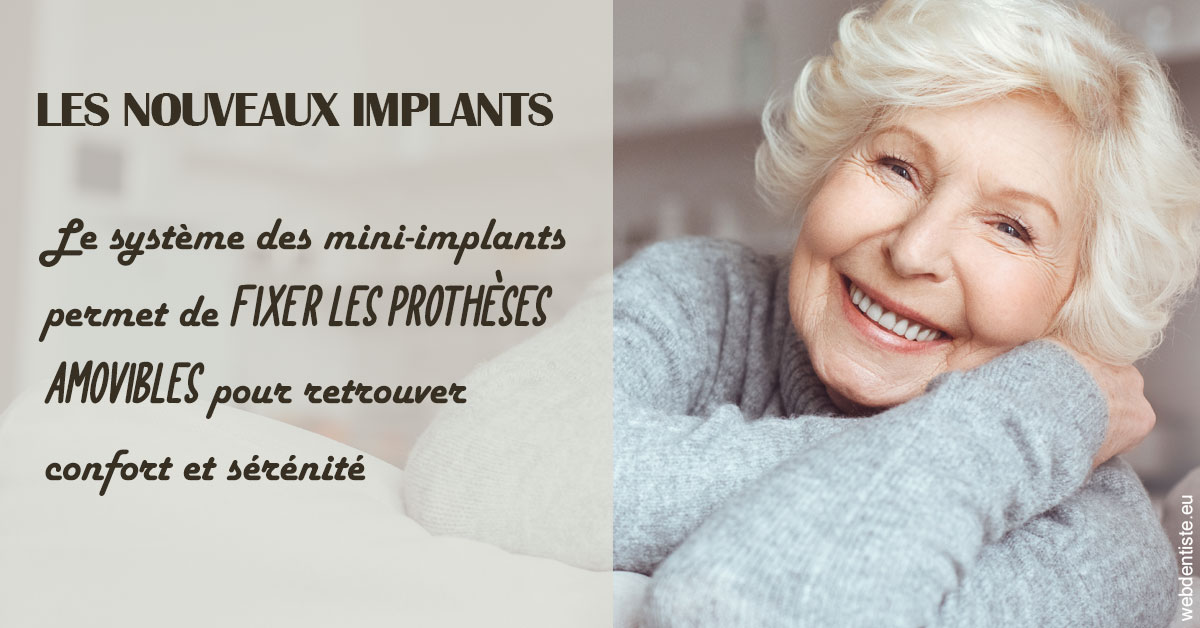 https://docteur-alexandre-benoit-lentrebecq.chirurgiens-dentistes.fr/Les nouveaux implants 1