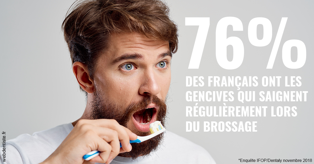 https://docteur-alexandre-benoit-lentrebecq.chirurgiens-dentistes.fr/76% des Français 2