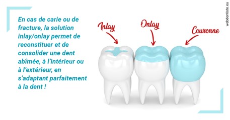 https://docteur-alexandre-benoit-lentrebecq.chirurgiens-dentistes.fr/L'INLAY ou l'ONLAY