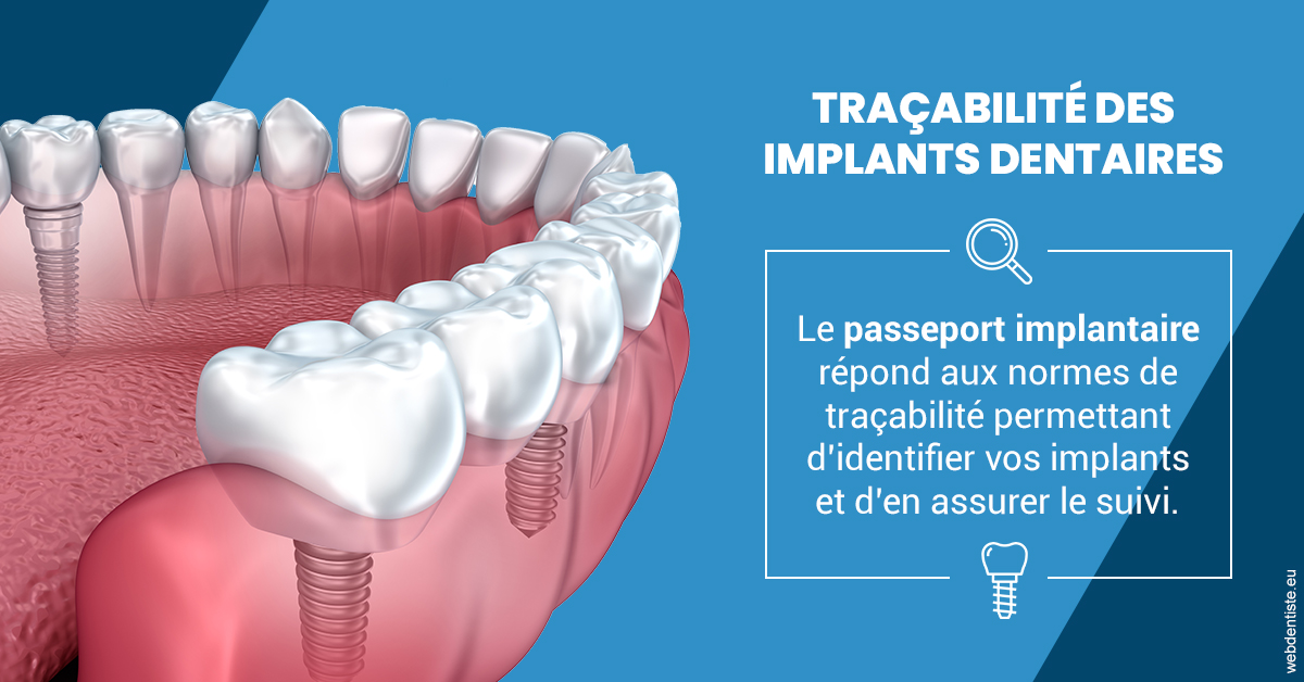 https://docteur-alexandre-benoit-lentrebecq.chirurgiens-dentistes.fr/T2 2023 - Traçabilité des implants 1