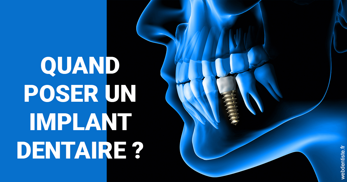 https://docteur-alexandre-benoit-lentrebecq.chirurgiens-dentistes.fr/Les implants 1