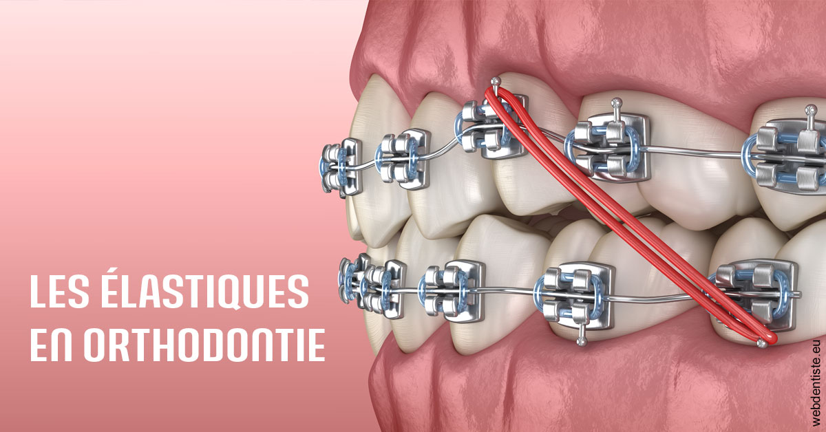 https://docteur-alexandre-benoit-lentrebecq.chirurgiens-dentistes.fr/Elastiques orthodontie 2