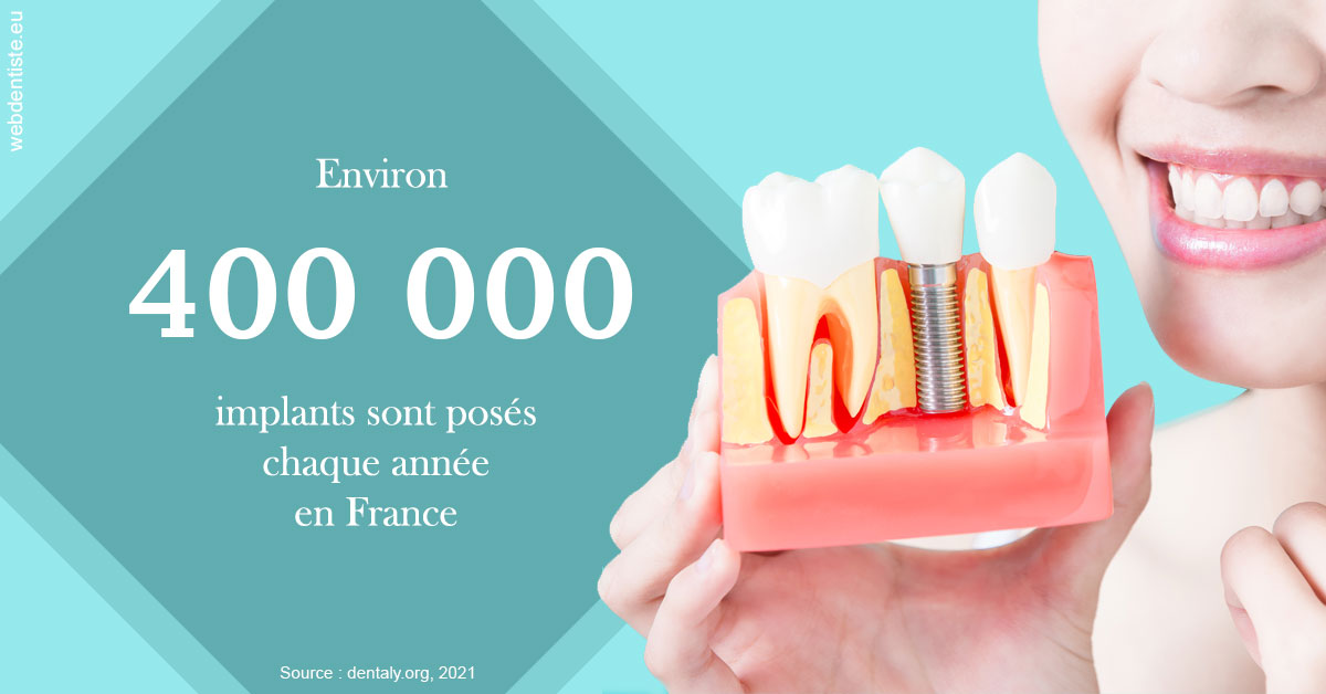 https://docteur-alexandre-benoit-lentrebecq.chirurgiens-dentistes.fr/Pose d'implants en France 2
